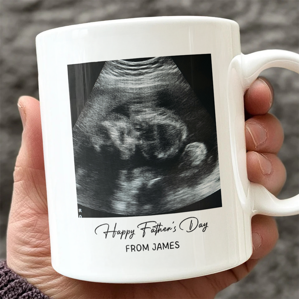 Custom Photo Happy Father's Day Baby Scan Mug - Gift For Father's Day TH10 169933 - Image 2
